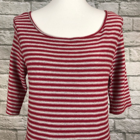 We The Free Frenchie Striped Open Back Dress - Picture 3 of 7